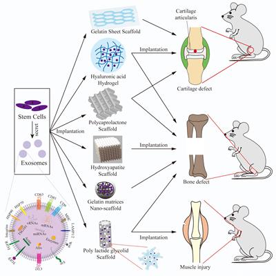 Technological Advances of 3D Scaffold-Based Stem Cell/Exosome Therapy in Tissues and Organs